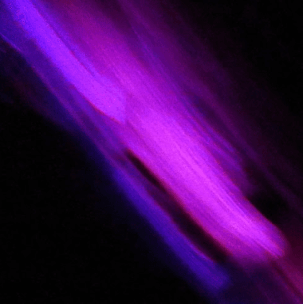 show
